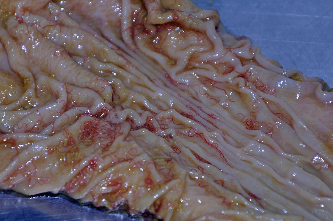 Barber’s pole worms feeding on blood on the mucosal surface  of a sheep stomach.