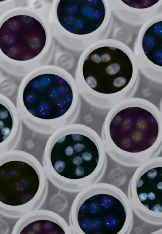 Photo: Images of genes (red, green, and blue spots within the nuclei of HeLa cells) are artificially superimposed on images of multi-well plates. on Unsplash, January 15, 2020. 