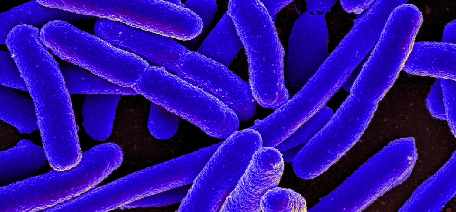 Resistance to antibiotics is on the rise worldwide because of the overuse and misuse of medications, which can also lead to other health issues like drug toxicity or complications. “Microbe” by NIAID via Foter.com is licensed under CC by 2.0.