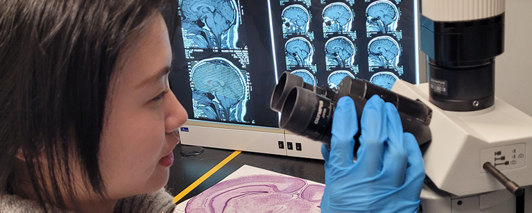 A woman peers into a microscope. Behind her is a screen showing scans of brains.