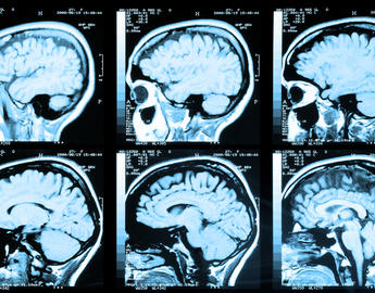 Brain scan sheet